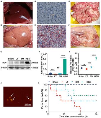 Intestinal Microbiota Participates in the Protective Effect of HO-1/BMMSCs on Liver Transplantation With Steatotic Liver Grafts in Rats